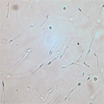 Sperm cryo-preservation